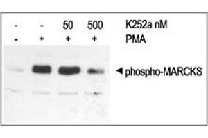 Cells were grown to 70 % confluence, and then serum starved for 18 h. (K252a)