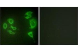 Immunofluorescence analysis of HepG2 cells, using MLTK Antibody.