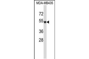 Western blot analysis in MDA-MB435 cell line lysates (35ug/lane). (TUBA3C Antikörper  (C-Term))