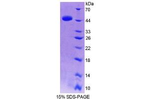 SDS-PAGE analysis of Human TRIP6 Protein. (TRIP6 Protein)