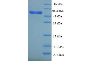 SDS-PAGE (SDS) image for Bone Morphogenetic Protein Receptor 1A (BMPR1A) (AA 177-532) protein (His-SUMO Tag) (ABIN5709147)