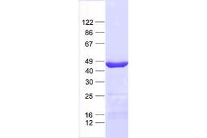 Western Blotting (WB) image for F-Box Protein 28 (FBXO28) protein (His tag) (ABIN2720951)