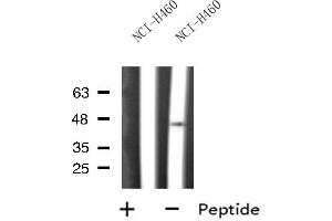 Western blot analysis of PDHA2 expression in NCI-H460 cell line lysates,The lane on the left is treated with the antigen-specific peptide. (PDHA2 Antikörper  (C-Term))