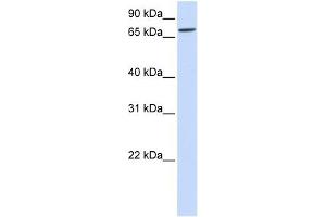 IL1RAPL2 antibody used at 1 ug/ml to detect target protein. (IL1RAPL2 Antikörper  (Middle Region))