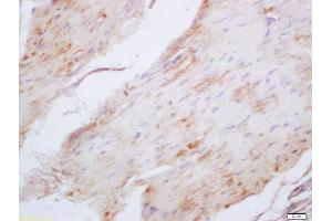 Formalin-fixed and paraffin embedded mouse stomach labeled with Anti-Elastin Polyclonal Antibody, Unconjugated (ABIN1386226) at 1:200 followed by conjugation to the secondary antibody and DAB staining (Elastin Antikörper  (AA 101-200))