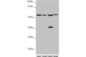 Western blot All lanes: SLC1A5 antibody at 9. (SLC1A5 Antikörper  (AA 1-100))