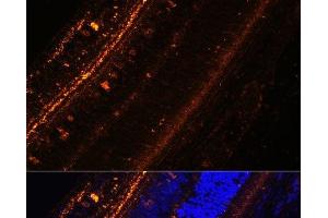 Immunofluorescence (IF) image for anti-Potassium Voltage-Gated Channel, Delayed-Rectifier, Subfamily S, Member 2 (KCNS2) antibody (ABIN7258586)