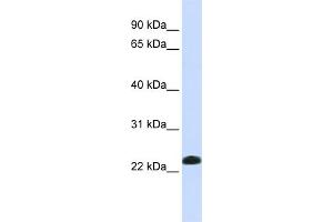 WB Suggested Anti-CAV2 Antibody Titration:  0. (Caveolin 2 Antikörper  (N-Term))