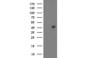 Western Blotting (WB) image for anti-Microtubule-Associated Protein, RP/EB Family, Member 2 (MAPRE2) antibody (ABIN1499320) (MAPRE2 Antikörper)