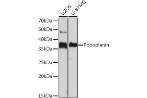 Western blot analysis of extracts of various cell lines, using Podoplanin Rabbit mAb (ABIN7269430) at 1:1000 dilution. (Podoplanin Antikörper)