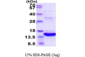 SDS-PAGE (SDS) image for S100 Calcium Binding Protein A8 (S100A8) (AA 1-93) protein (His tag,MYC tag) (ABIN5854609)