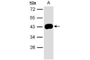 WB Image Sample(30 μg of whole cell lysate) A:A431, 10% SDS PAGE antibody diluted at 1:1000 (SERPINB5 Antikörper  (Center))