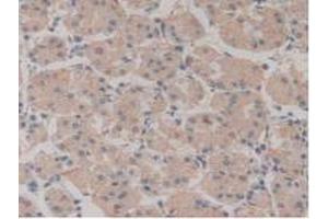 IHC-P analysis of Human Stomach Tissue, with DAB staining. (NUP210 Antikörper  (AA 1288-1449))