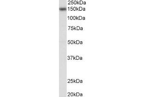 Western Blotting (WB) image for anti-Nuclear Factor of Activated T-Cells, Cytoplasmic, Calcineurin-Dependent 3 (NFATC3) (Internal Region) antibody (ABIN2613459)