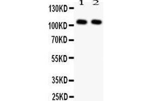 Anti- NFkB p105/p50 antibody,  Western blotting All lanes: Anti NFkB p105/p50() at 0.