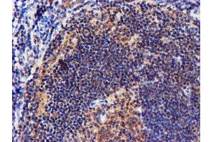 Image no. 5 for anti-NADH Dehydrogenase (Ubiquinone) Complex I, Assembly Factor 7 (NDUFAF7) antibody (ABIN1499667) (NDUFAF7 Antikörper)