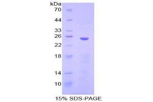 SDS-PAGE (SDS) image for Inhibitor of KB Kinase beta Interacting Protein (IKbIP) (AA 132-314) protein (His tag) (ABIN1879415)