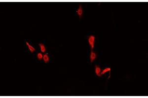 ABIN6266478 staining U-2 OS cells by IF/ICC. (CEBPE Antikörper  (Internal Region))