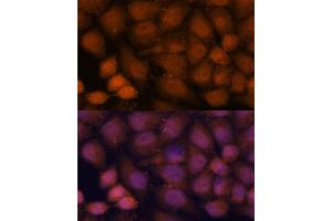 Immunofluorescence analysis of HeLa cells using CEP85 antibody (ABIN7266281) at dilution of 1:100. (CEP85 Antikörper  (AA 130-430))