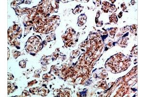 Immunohistochemical analysis of paraffin-embedded Human-placenta, antibody was diluted at 1:100 (BMPR1B Antikörper  (AA 21-70))