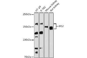 Western blot analysis of extracts of various cell lines, using IRS2 antibody (ABIN6128094, ABIN6142544, ABIN6142545 and ABIN6223949) at 1:500 dilution.
