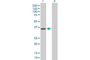 Western Blot analysis of CRELD2 expression in transfected 293T cell line by CRELD2 MaxPab polyclonal antibody. (CRELD2 Antikörper  (AA 1-321))