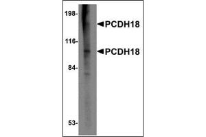 Western blot analysis of PCDH18 in Raji cell lysate with this product at 2 μg/ml. (PCDH18 Antikörper  (N-Term))