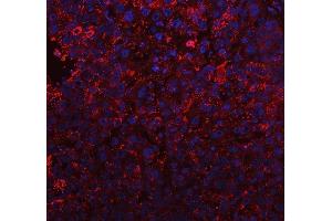 anti-Transmembrane BAX Inhibitor Motif Containing 6 (TMBIM6) (N-Term) antibody