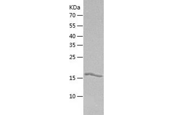 GUK1 Protein (AA 1-197) (His tag)