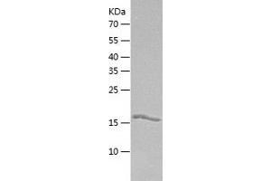 Western Blotting (WB) image for Guanylate Kinase 1 (GUK1) (AA 1-197) protein (His tag) (ABIN7123245)