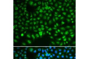Immunofluorescence analysis of HeLa cells using DLGAP5 Polyclonal Antibody (DLGAP5 Antikörper)