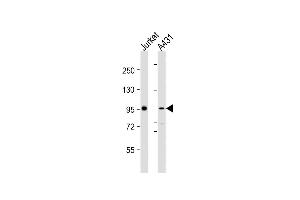 All lanes : Anti-NCSTN Antibody (N-Term) at 1:2000 dilution Lane 1: Jurkat whole cell lysates Lane 2: A431 whole cell lysates Lysates/proteins at 20 μg per lane. (Nicastrin Antikörper  (AA 99-133))