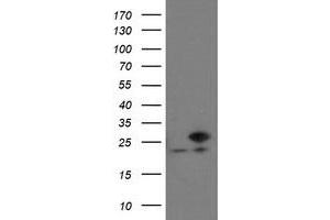 Western Blotting (WB) image for anti-Prefoldin Subunit 3 (PFDN3) antibody (ABIN1501703) (VBP1 Antikörper)