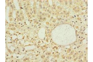 Immunohistochemistry of paraffin-embedded human adrenal gland tissue using ABIN7150520 at dilution of 1:100