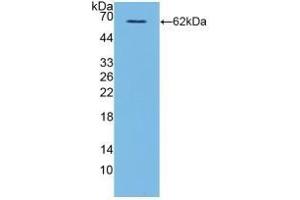 Detection of Recombinant CD40L, Human using Polyclonal Antibody to Cluster Of Differentiation 40 Ligand (CD40L)