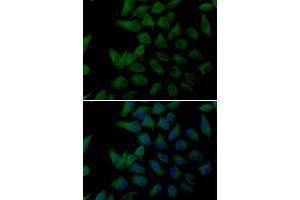 Immunofluorescence analysis of U20S cell using PLOD2 antibody. (PLOD2 Antikörper)