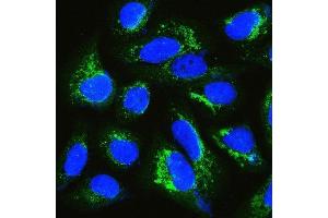 IF analysis of IQGAP1 using anti-IQGAP1 antibody (ABIN6719262).