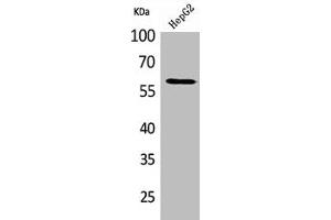 Western Blot analysis of HepG2 cells using HEXA Polyclonal Antibody (Hexosaminidase A Antikörper  (Internal Region))