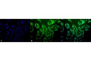 Immunocytochemistry/Immunofluorescence analysis using Mouse Anti-Ubiquitin Monoclonal Antibody, Clone 5B9-B3 (ABIN361810 and ABIN361811). (Ubiquitin Antikörper)