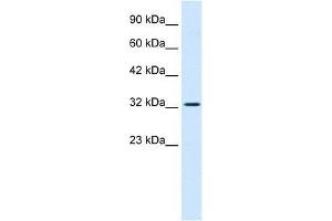 Western Blotting (WB) image for anti-SWI/SNF Related, Matrix Associated, Actin Dependent Regulator of Chromatin, Subfamily A, Member 2 (SMARCA2) (Middle Region) antibody (ABIN927492)