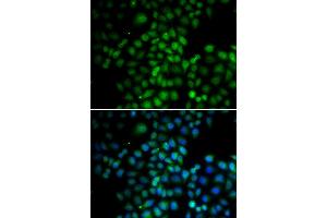 Immunofluorescence analysis of HeLa cells using C11orf30 antibody (ABIN6290348).