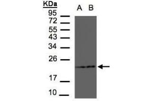 Figure 1. (RAMP2 Antikörper  (AA 111-175))