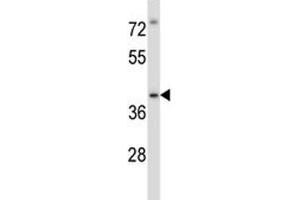 Irak4 antibody western blot analysis in MDA-MB435 lysate.