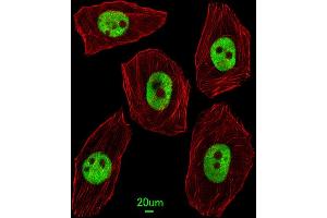 Immunofluorescent analysis of  cells, using UNCX Antibody (C-term) (ABIN655115 and ABIN2844746). (UNCX Antikörper  (C-Term))