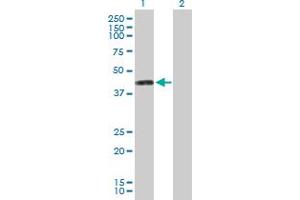 Western Blot analysis of PTDSS1 expression in transfected 293T cell line by PTDSS1 MaxPab polyclonal antibody. (PTDSS1 Antikörper  (AA 1-473))