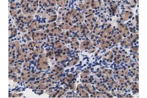 Immunohistochemical staining of paraffin-embedded Human colon tissue using anti-CD80 mouse monoclonal antibody. (CD80 Antikörper)