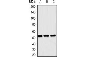 Western blot analysis of Matrilin 3 expression in mouse liver (A), mouse brain (B), rat liver (C) whole cell lysates.