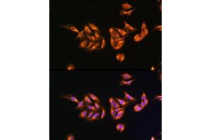 Immunofluorescence analysis of U-2 OS cells using MRPS27 Rabbit pAb  at dilution of 100 (40x lens). (MRPS27 Antikörper  (AA 255-414))