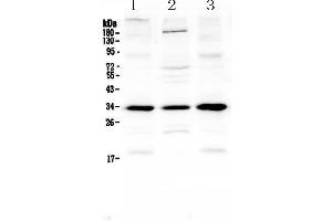 Western blot analysis of MyD88 using anti-MyD88 antibody . (MYD88 Antikörper  (AA 12-263))