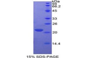 SDS-PAGE analysis of IL17 Protein. (IL-17 Protein)